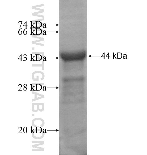 CCDC120 fusion protein Ag14319 SDS-PAGE