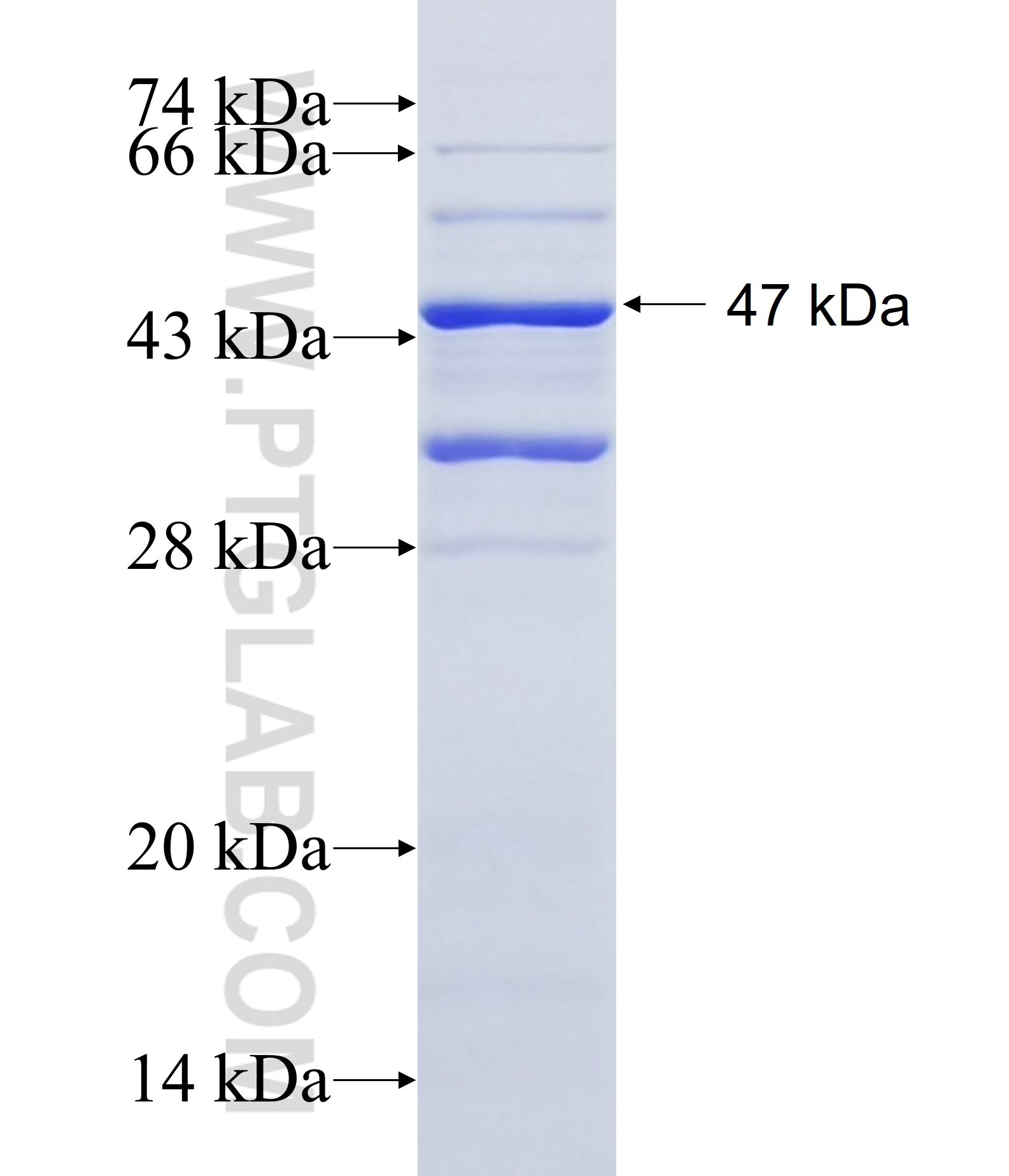 CCDC120 fusion protein Ag14319 SDS-PAGE