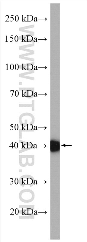 WB analysis of SH-SY5Y using 24002-1-AP