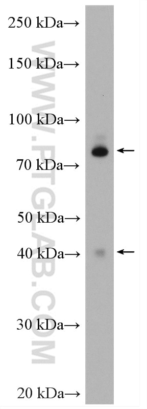 Western Blot (WB) analysis of SH-SY5Y cells using CEP89, CCDC123 Polyclonal antibody (24002-1-AP)