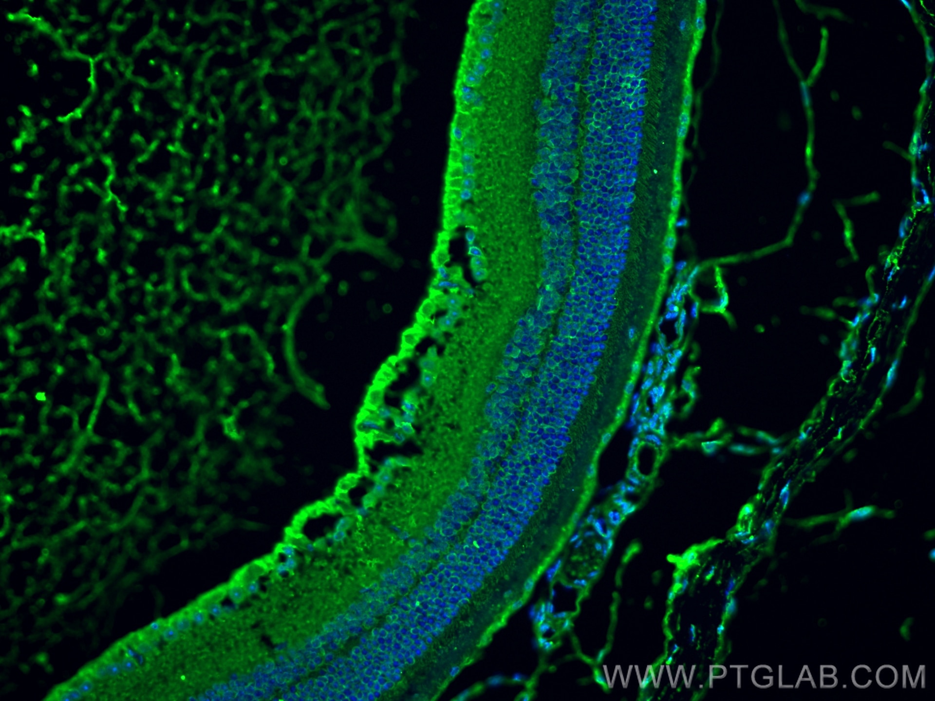 Immunofluorescence (IF) / fluorescent staining of mouse eye tissue using CEP89, CCDC123 Monoclonal antibody (68112-1-Ig)