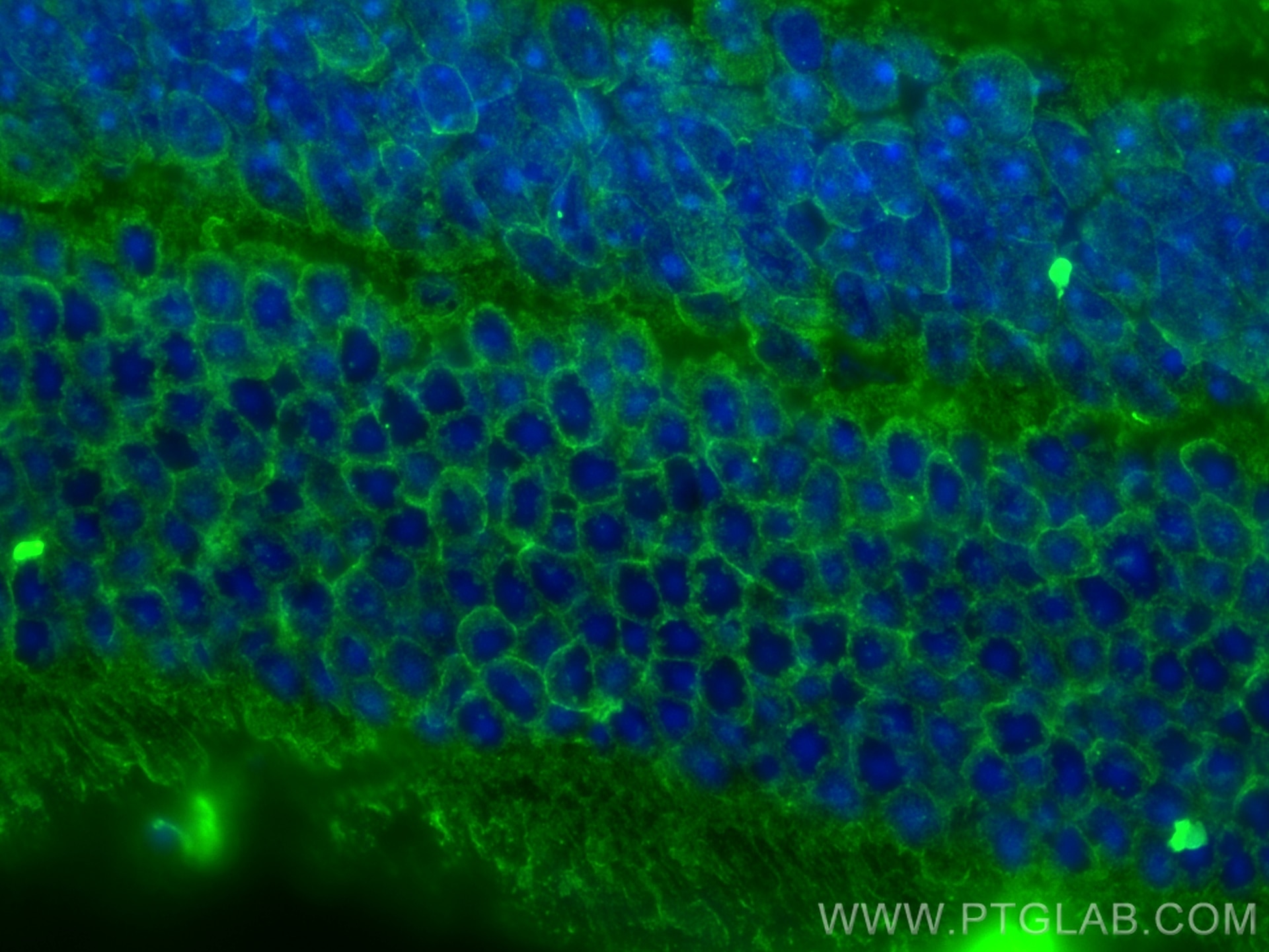 Immunofluorescence (IF) / fluorescent staining of mouse eye tissue using CEP89, CCDC123 Monoclonal antibody (68112-1-Ig)