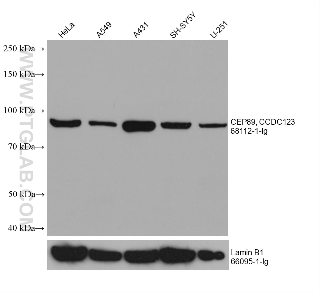 Western Blot (WB) analysis of various lysates using CEP89, CCDC123 Monoclonal antibody (68112-1-Ig)