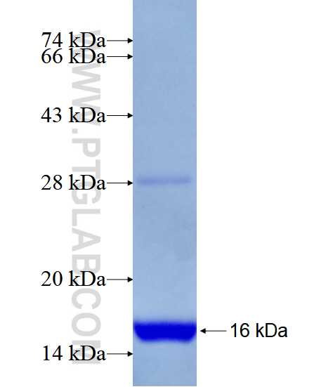 CCDC123 fusion protein Ag28339 SDS-PAGE