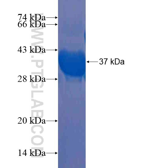 CCDC123 fusion protein Ag21206 SDS-PAGE