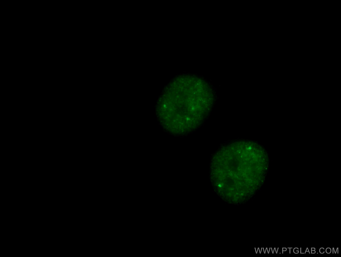 Immunofluorescence (IF) / fluorescent staining of HeLa cells using CCDC124 Polyclonal antibody (27106-1-AP)