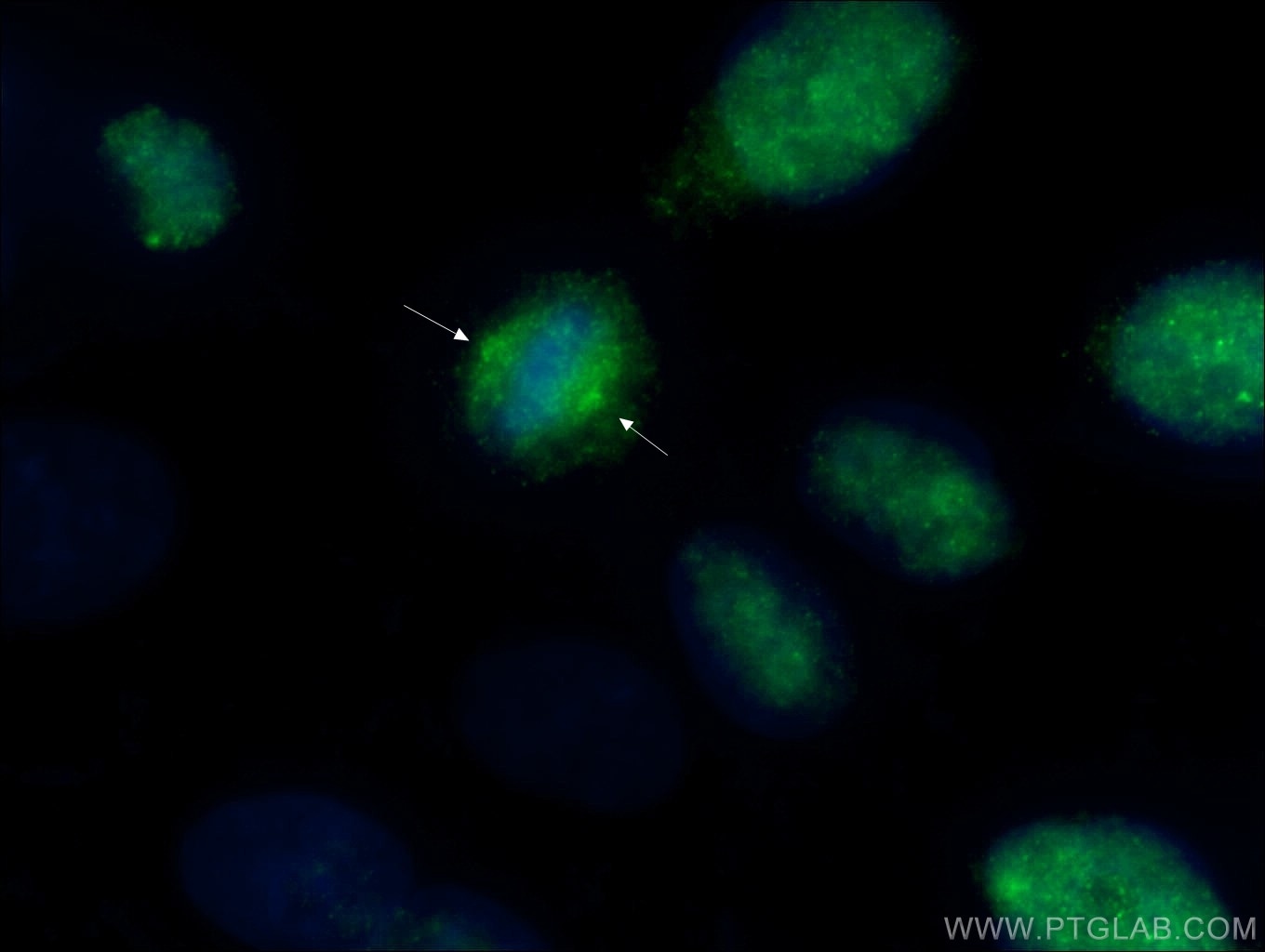 Immunofluorescence (IF) / fluorescent staining of HeLa cells using CCDC124 Polyclonal antibody (27106-1-AP)