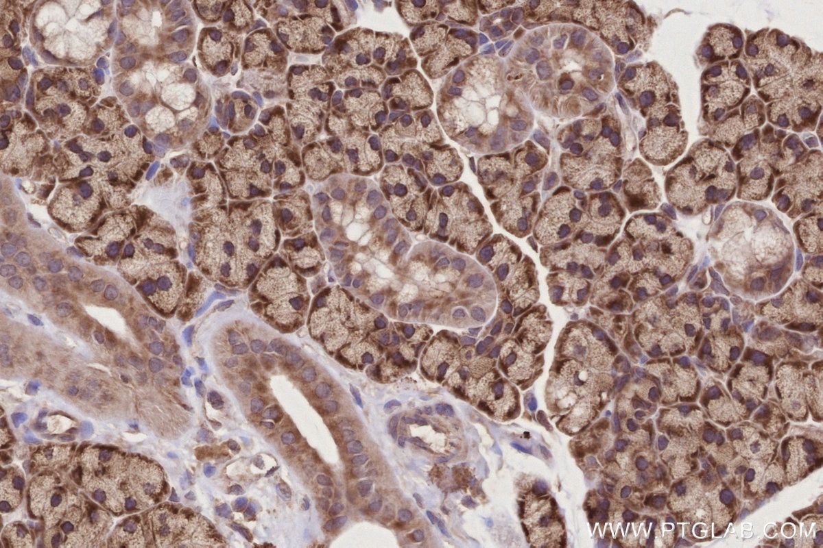 IHC staining of rat salivary gland using 27106-1-AP Immunohistochemistry (IHC) staining of rat salivary gland tissue using CCDC124 Polyclonal antibody (27106-1-AP)