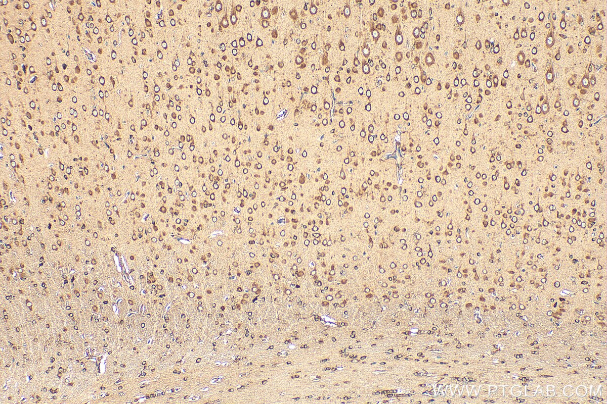 Immunohistochemical analysis of paraffin-embedded rat brain tissue slide using 27106-1-AP (CCDC124 antibody) at dilution of 1:200 (under 10x lens). Heat mediated antigen retrieval with Tris-EDTA buffer (pH 9.0). Immunohistochemistry (IHC) staining of rat brain tissue using CCDC124 Polyclonal antibody (27106-1-AP)