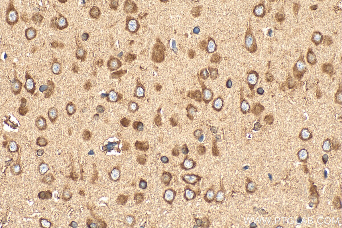 Immunohistochemical analysis of paraffin-embedded rat brain tissue slide using 27106-1-AP (CCDC124 antibody) at dilution of 1:200 (under 40x lens). Heat mediated antigen retrieval with Tris-EDTA buffer (pH 9.0). Immunohistochemistry (IHC) staining of rat brain tissue using CCDC124 Polyclonal antibody (27106-1-AP)