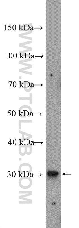 Western Blot (WB) analysis of human placenta tissue using CCDC124 Polyclonal antibody (27106-1-AP)