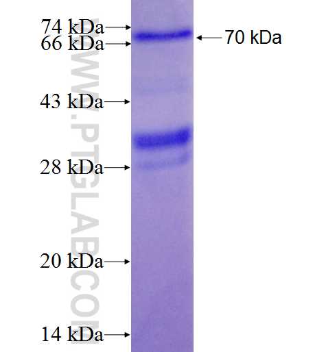 CCDC132 fusion protein Ag26944 SDS-PAGE