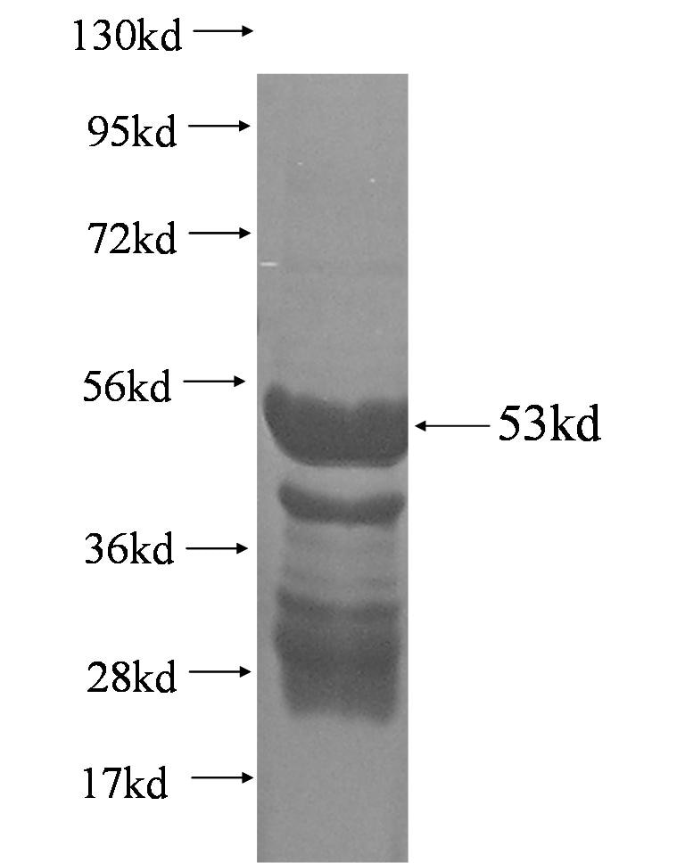 CCDC134 fusion protein Ag0619 SDS-PAGE