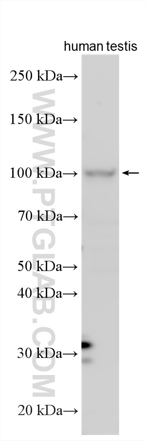 WB analysis using 26307-1-AP (same clone as 26307-1-PBS) Western Blot (WB) analysis of various lysates using CCDC135 Polyclonal antibody (26307-1-AP)