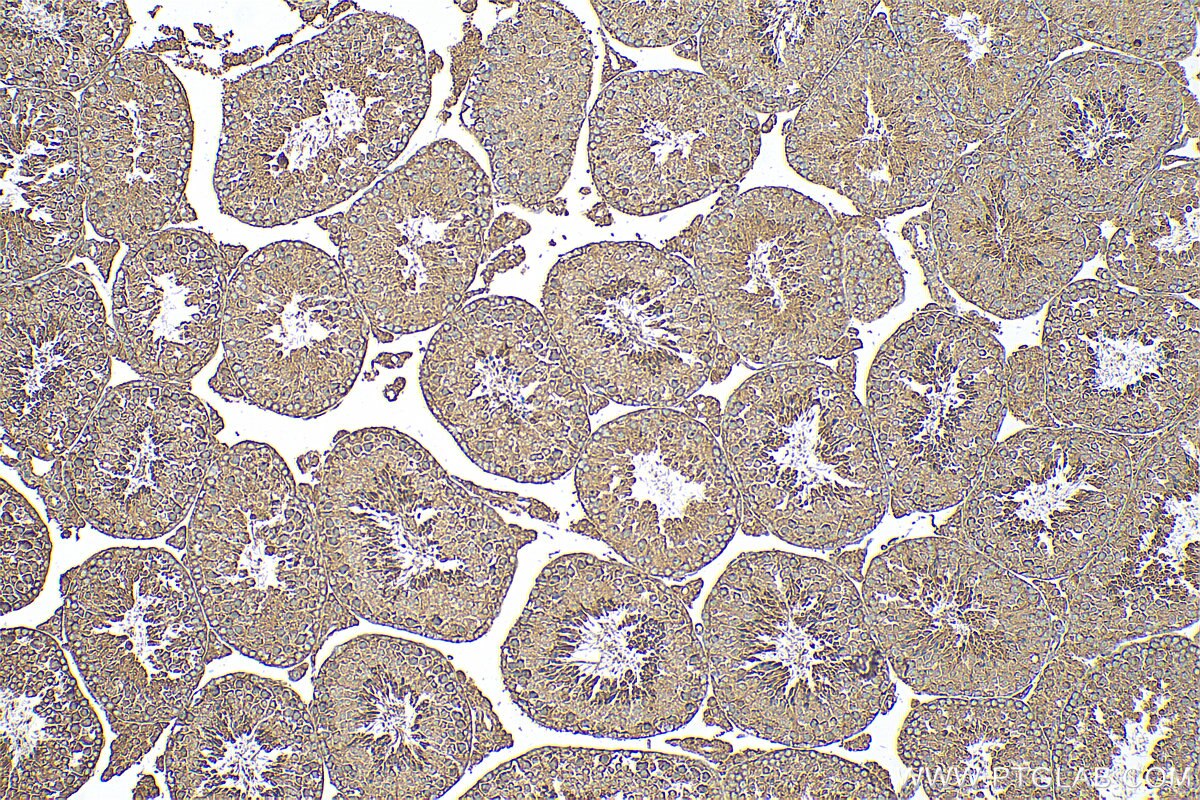 Immunohistochemistry (IHC) staining of mouse testis tissue using CCDC136 Polyclonal antibody (21351-1-AP)