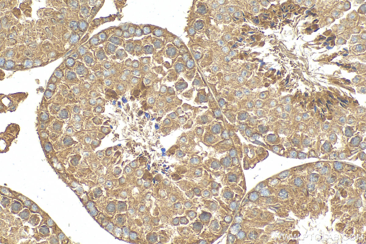 Immunohistochemistry (IHC) staining of mouse testis tissue using CCDC136 Polyclonal antibody (21351-1-AP)
