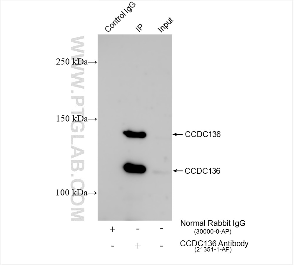 Immunoprecipitation (IP) experiment of mouse testis tissue using CCDC136 Polyclonal antibody (21351-1-AP)