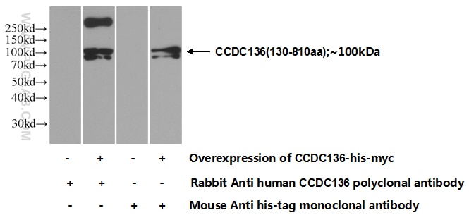 CCDC136