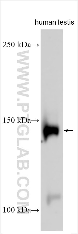 Western Blot (WB) analysis of various lysates using CCDC136 Polyclonal antibody (21351-1-AP)