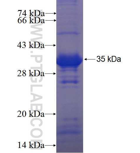 CCDC137 fusion protein Ag23942 SDS-PAGE