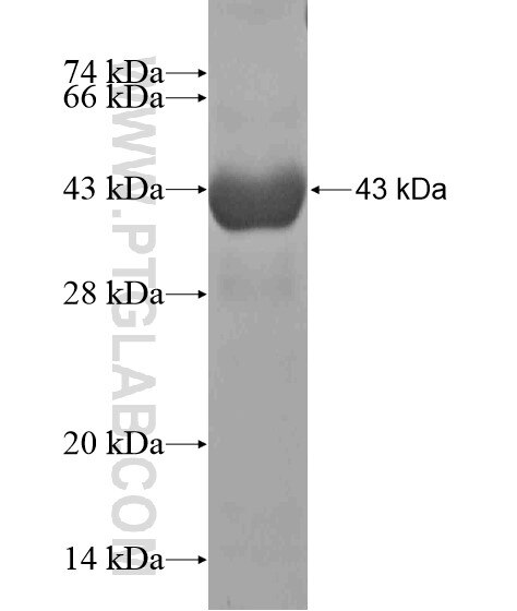 CCDC141 fusion protein Ag19969 SDS-PAGE