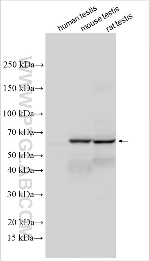 Western Blot (WB) analysis of various lysates using CCDC151 Polyclonal antibody (31680-1-AP)