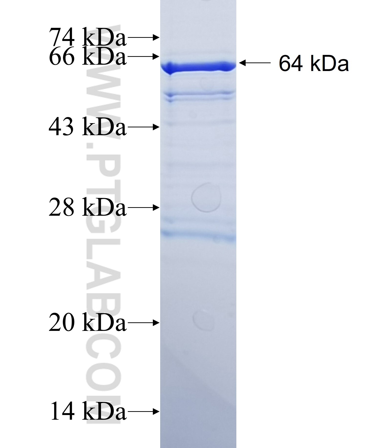 CCDC151 fusion protein Ag34867 SDS-PAGE