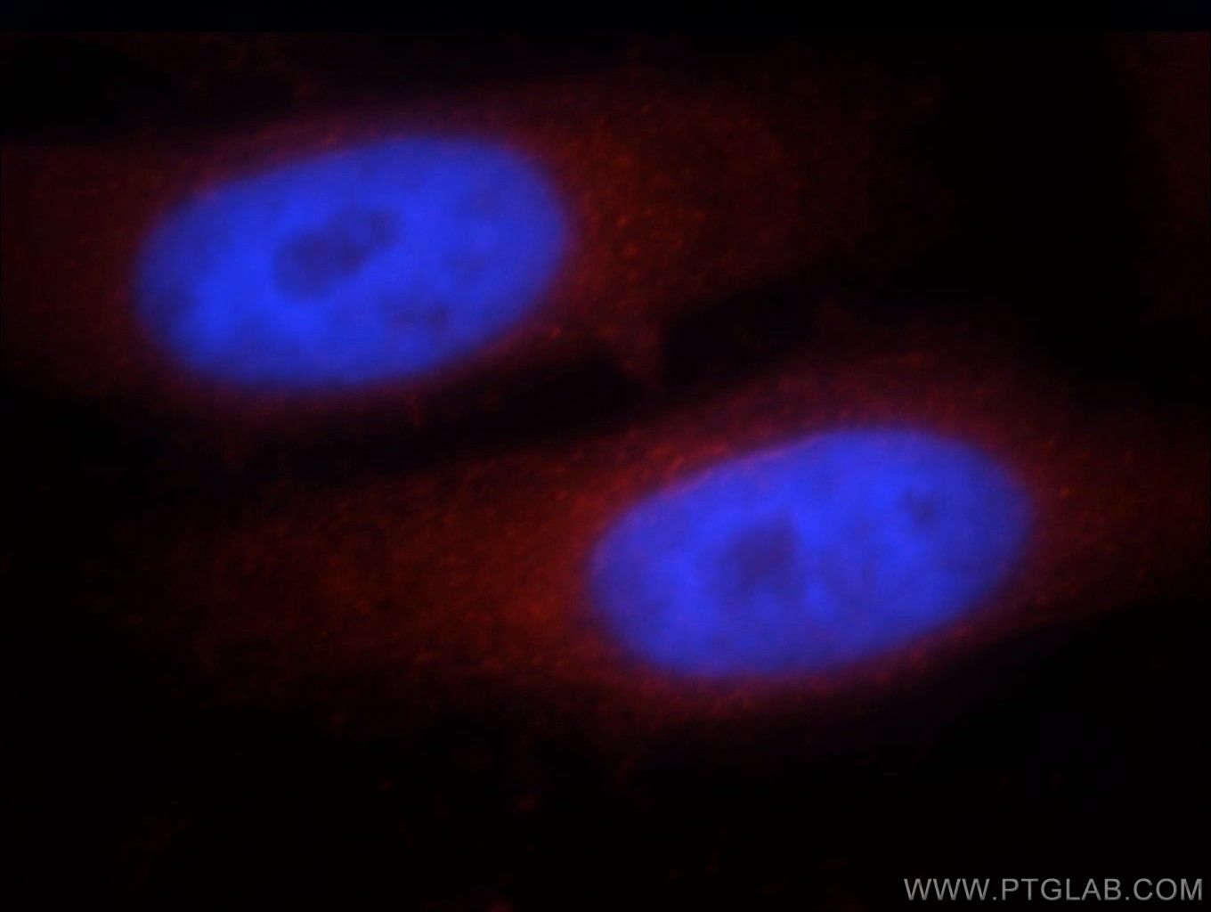 Immunofluorescence (IF) / fluorescent staining of HepG2 cells using CCDC153 Polyclonal antibody (21390-1-AP)