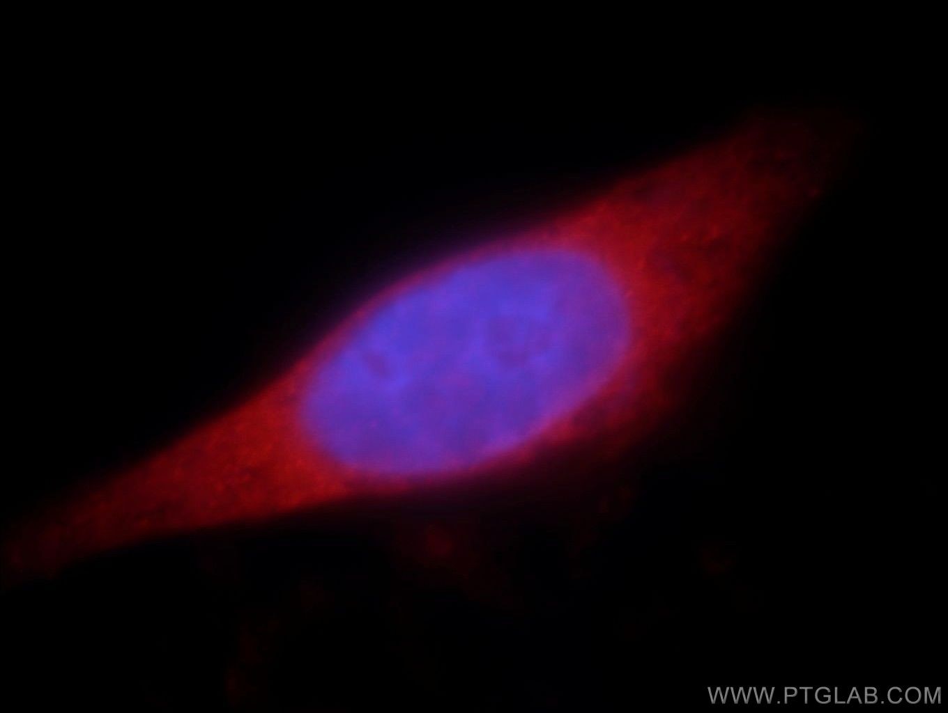 Immunofluorescence (IF) / fluorescent staining of HeLa cells using CCDC153 Polyclonal antibody (21390-1-AP)