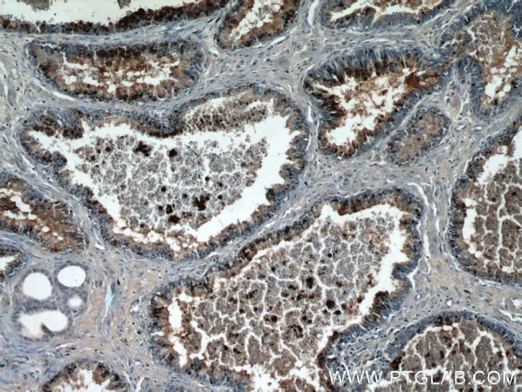 Immunohistochemistry (IHC) staining of human prostate hyperplasia tissue using CCDC153 Polyclonal antibody (21390-1-AP)
