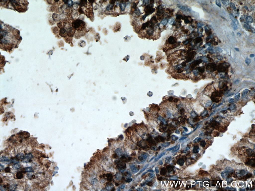 Immunohistochemistry (IHC) staining of human prostate hyperplasia tissue using CCDC153 Polyclonal antibody (21390-1-AP)