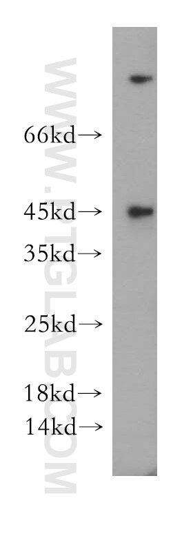 Western Blot (WB) analysis of human brain tissue using CCDC153 Polyclonal antibody (21390-1-AP)