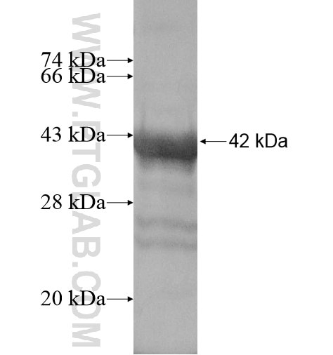 CCDC153 fusion protein Ag16044 SDS-PAGE