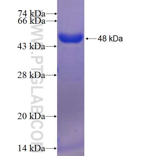 CCDC155 fusion protein Ag23791 SDS-PAGE