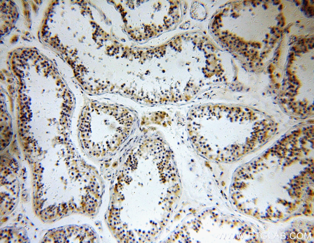 Immunohistochemistry (IHC) staining of human testis tissue using CCDC158 Polyclonal antibody (20396-1-AP)