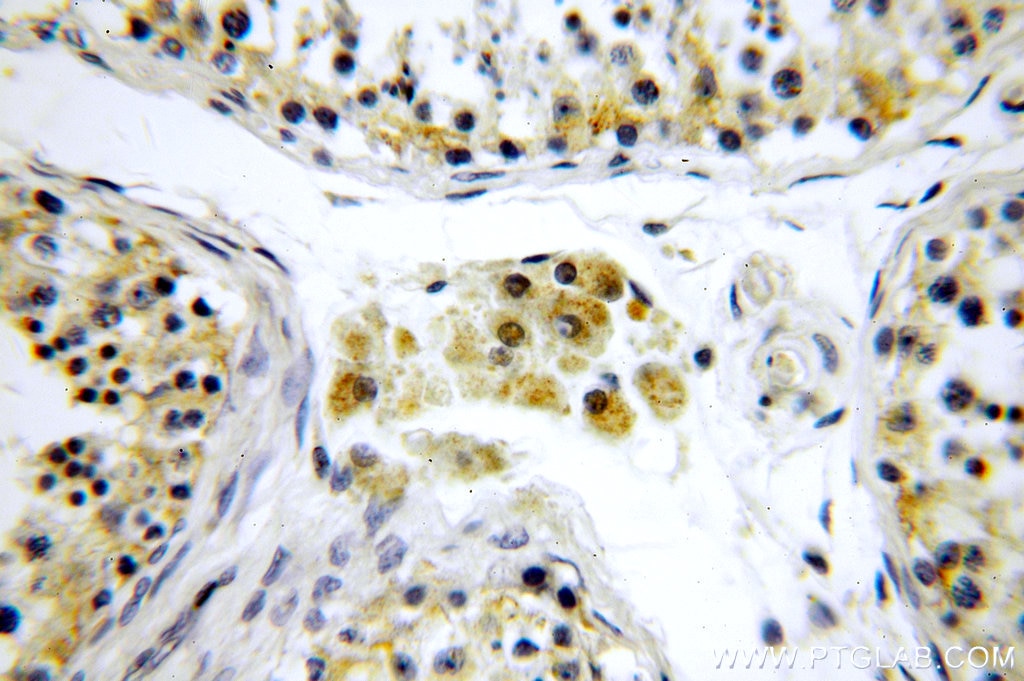 Immunohistochemistry (IHC) staining of human testis tissue using CCDC158 Polyclonal antibody (20396-1-AP)