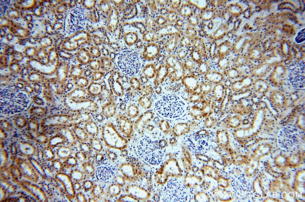 Immunohistochemistry (IHC) staining of human kidney tissue using CCDC158 Polyclonal antibody (20396-1-AP)