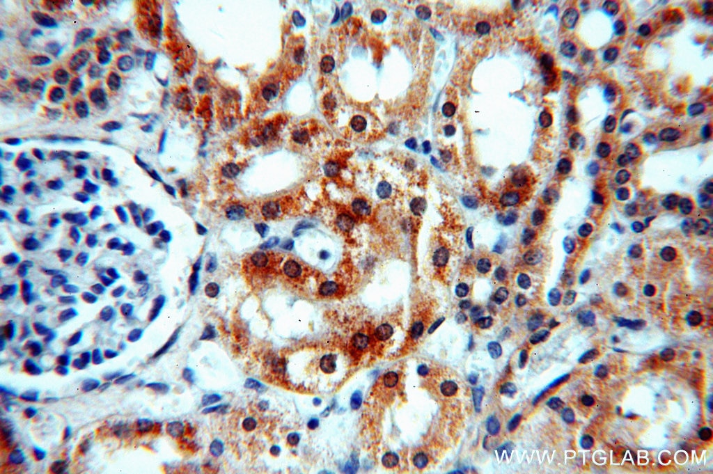 Immunohistochemistry (IHC) staining of human kidney tissue using CCDC158 Polyclonal antibody (20396-1-AP)