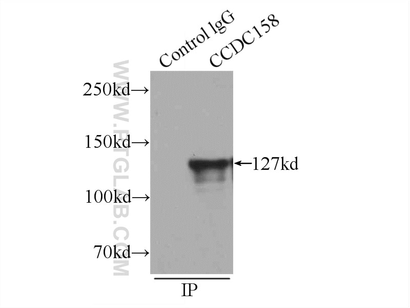Immunoprecipitation (IP) experiment of mouse testis tissue using CCDC158 Polyclonal antibody (20396-1-AP)
