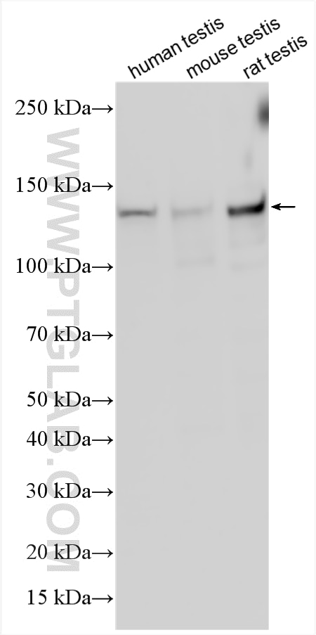 WB analysis using 20396-1-AP Western Blot (WB) analysis of various lysates using CCDC158 Polyclonal antibody (20396-1-AP)