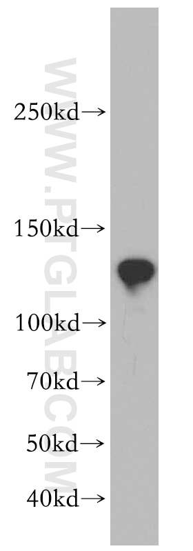 Western Blot (WB) analysis of mouse testis tissue using CCDC158 Polyclonal antibody (20396-1-AP)