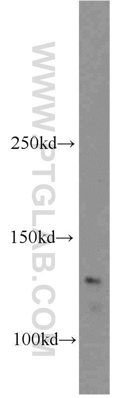 Western Blot (WB) analysis of human testis tissue using CCDC158 Polyclonal antibody (20396-1-AP)