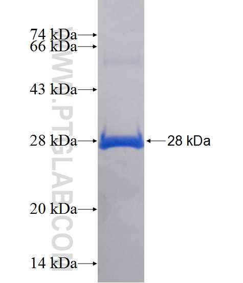 CCDC158 fusion protein Ag14049 SDS-PAGE