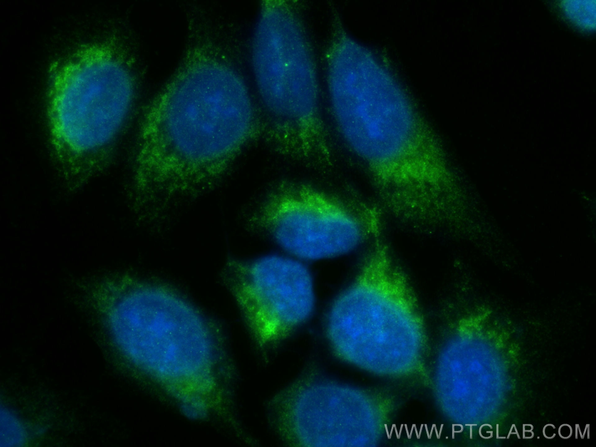 Immunofluorescence (IF) / fluorescent staining of U2OS cells using CCDC167 Polyclonal antibody (31922-1-AP)