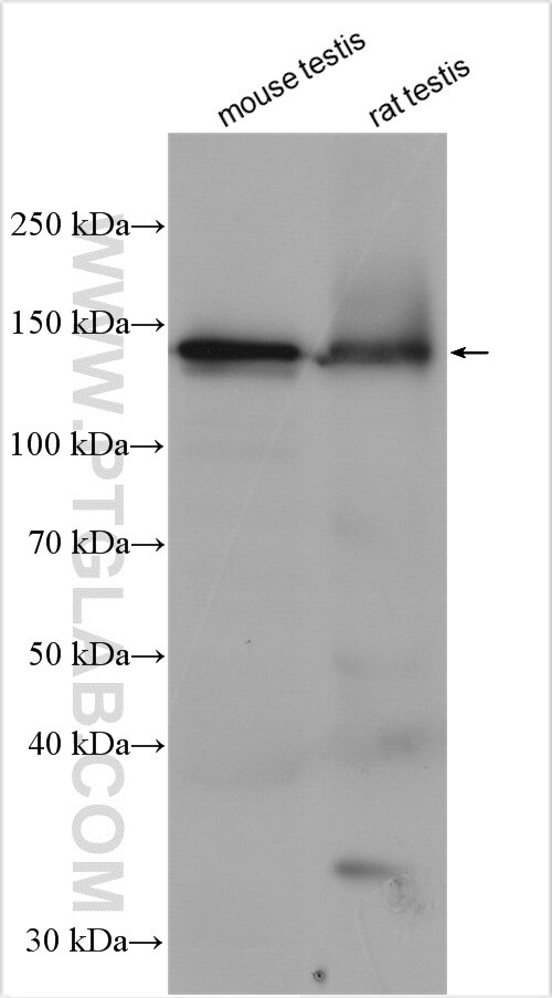 Western Blot (WB) analysis of various lysates using CCDC171 Polyclonal antibody (28433-1-AP)