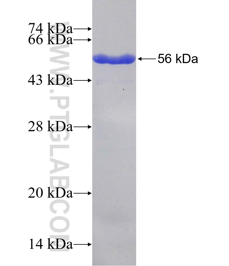 CCDC171 fusion protein Ag28926 SDS-PAGE