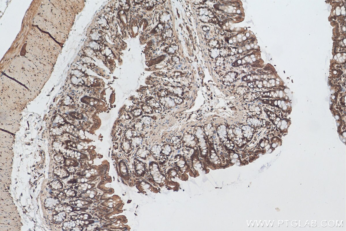 Immunohistochemistry (IHC) staining of rat colon tissue using CCDC18 Polyclonal antibody (30024-1-AP)