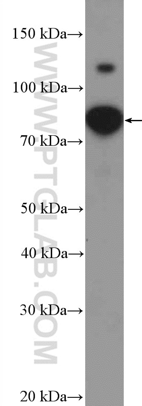 Western Blot (WB) analysis of Jurkat cells using CCDC21 Polyclonal antibody (26314-1-AP)