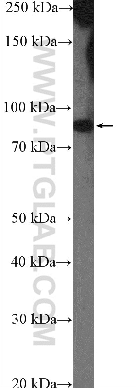 Western Blot (WB) analysis of HeLa cells using CCDC21 Polyclonal antibody (26314-1-AP)