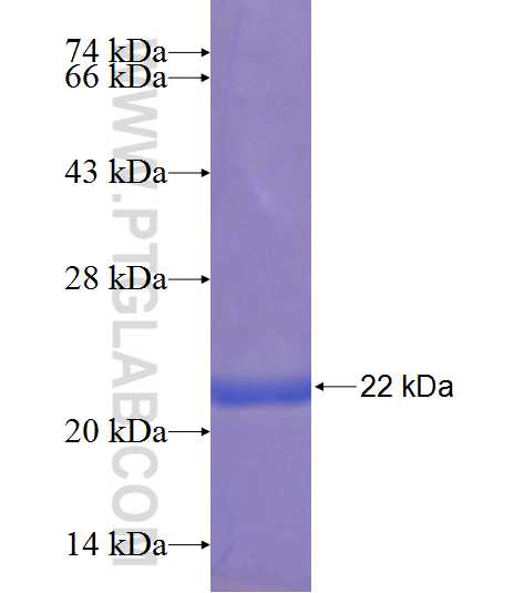 CCDC21 fusion protein Ag23636 SDS-PAGE